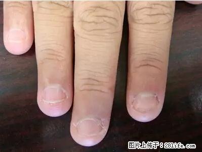 剪指甲、挖耳屎，这些日常小动作竟隐藏大危害！ - 乌鲁木齐生活资讯 - 乌鲁木齐28生活网 xj.28life.net
